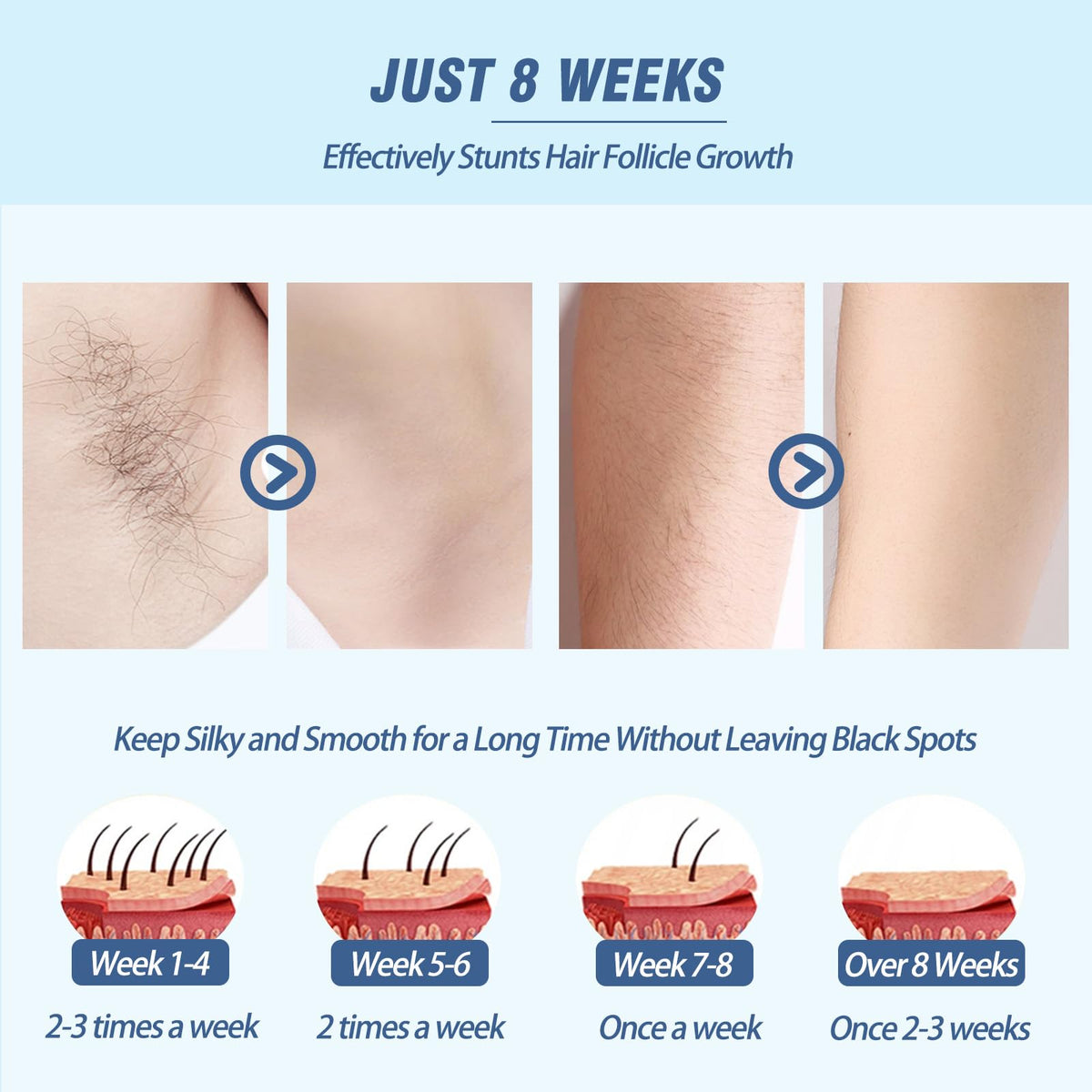 IPL Laser Hair Removal,ZPL 999999 Flashes 2 in 1 Painless Hair Remover Machine with Razor & Goggles,5 Levels,LCD Display